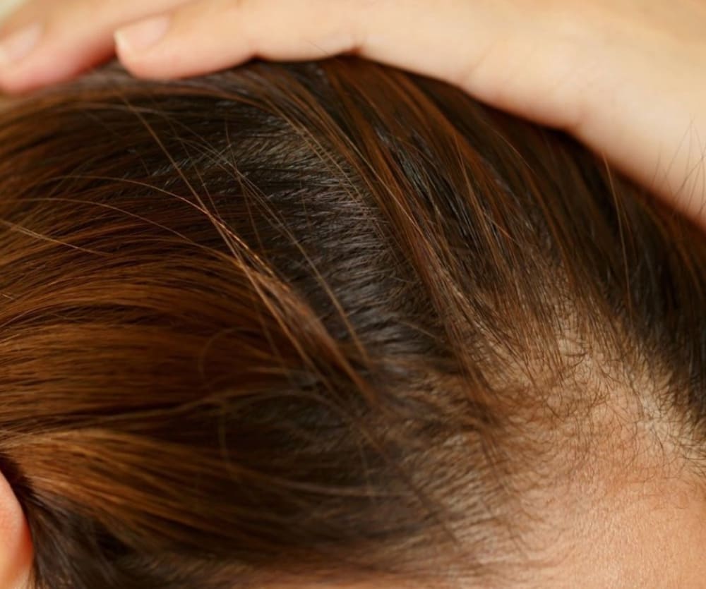 Ампули від випадіння волосся: відгуки