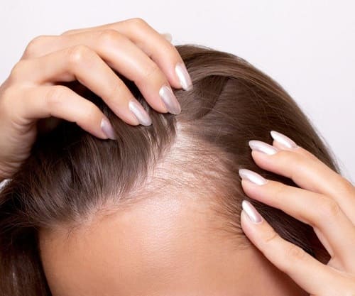 Як працюють шампуні проти випадіння волосся