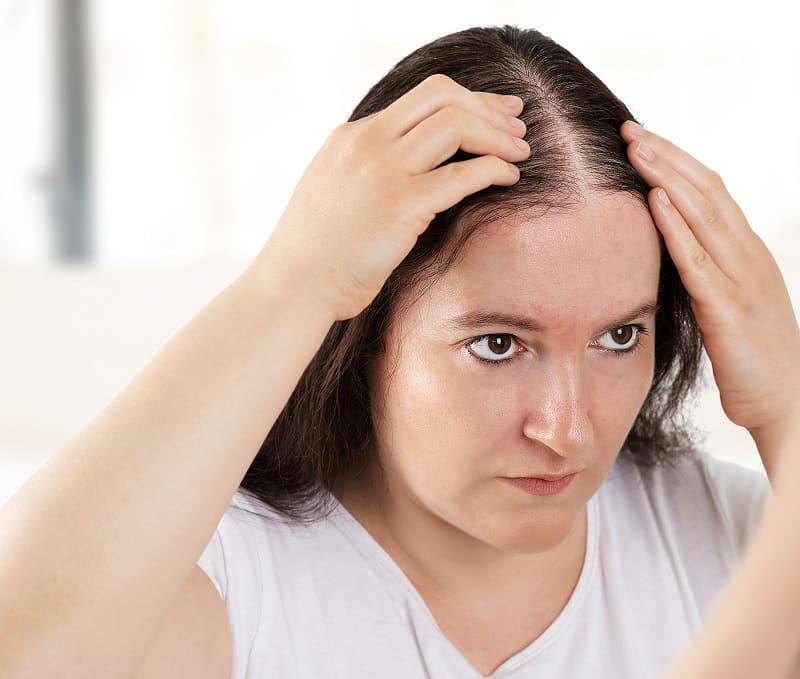 Випадіння волосся: чому це відбувається і як повернути густоту локонам