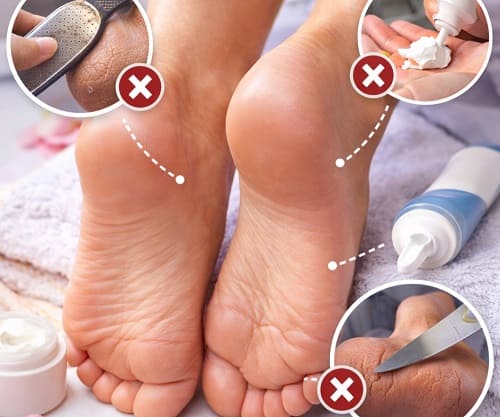 Типичные ошибки ухода за ногами