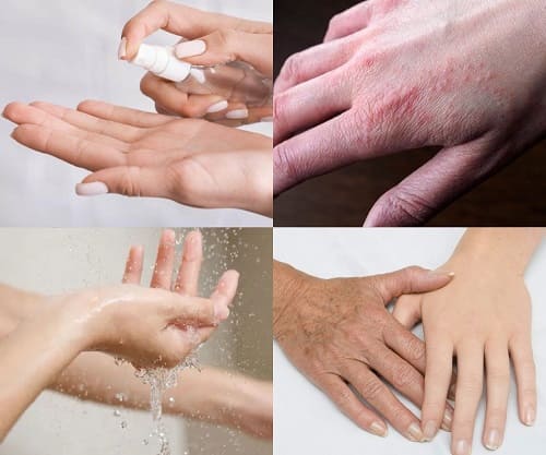 Основні причини сухості рук