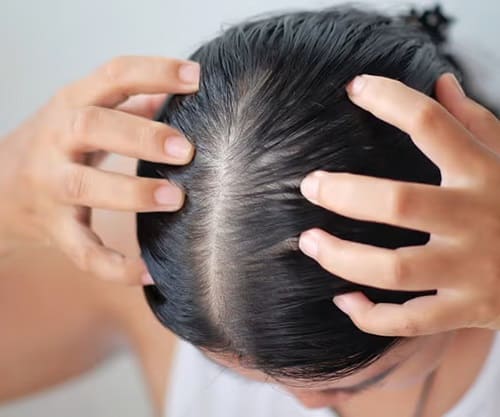 Правильная техника самомассажа кожи головы