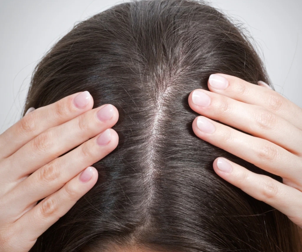 Як зрозуміти, який у вас тип волосся