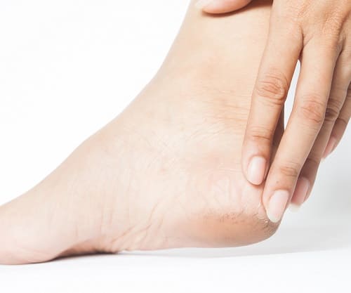 сухие стопы