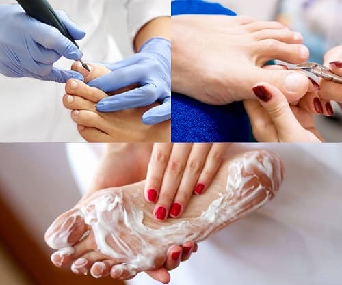 Какой педикюр безопасен при сухости стоп