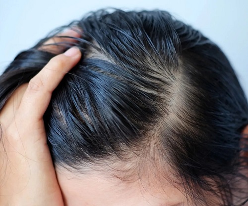 Как часто мыть голову