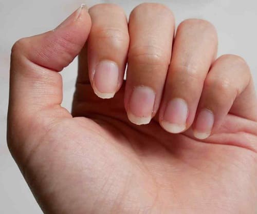 Чи можливо відростити нігті за 3 дні?