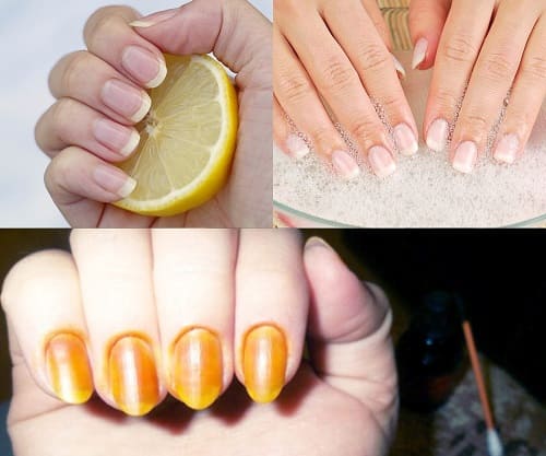 Как укрепить ногти йодом и другие народные мифы