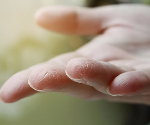 Чим насправді шкідливий ацетон?